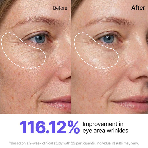 Peptide lifting and firming routine results