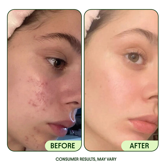 Korean toner pads results